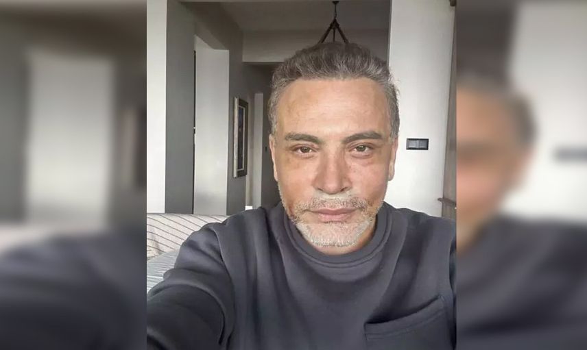 Cenk Eren yüz gerdirme ameliyatı oldu! Son hali herkesi şoke etti!