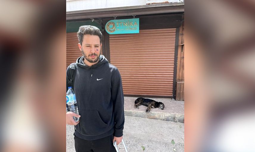 Ünlü oyuncu Tuan Tunalı’ya köpek saldırdı! Yüzü paramparça oldu