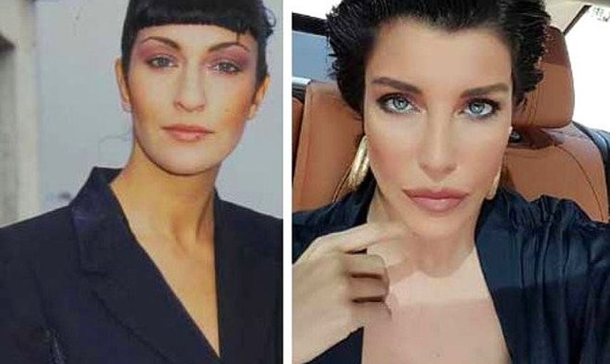 Deniz Akkaya'nın Estetiksiz Hali Görenleri Hayrete Düşürdü