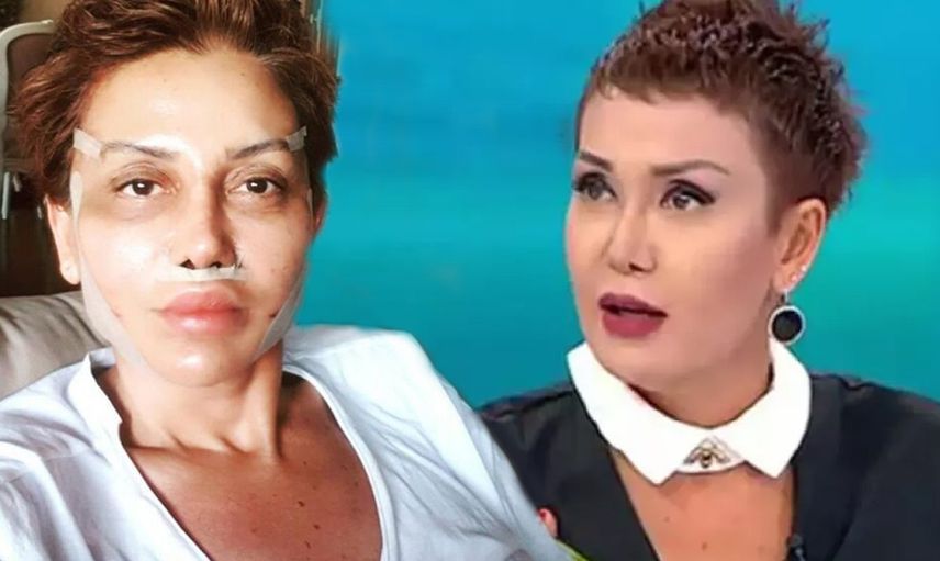 Seda Sayan’ın estetik doktoruna giden Serap Paköz değişimiyle herkesi şaşırttı! Kimse tanıyamıyor