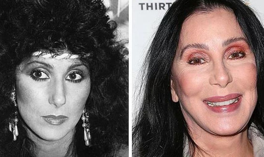 Cher