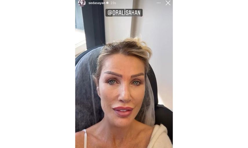 Seda Sayan ölümden döndü: Genç kocasına güzel görünmek için estetik yaptırdı, yüzü tanınmaz hale geldi