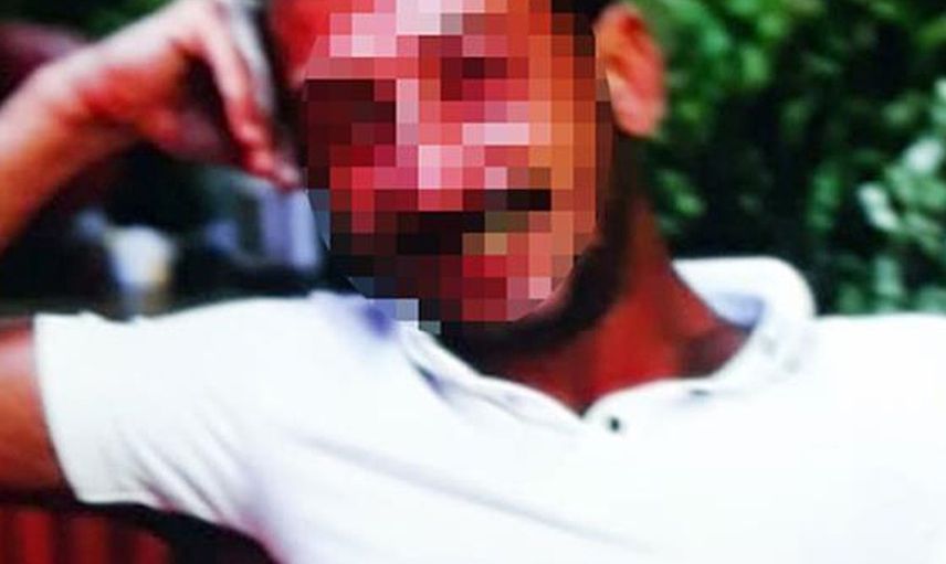 Antalya'da Eğlendiği Kadını Önce Bıçakla Tehdit Etti Sonra da Saldırıda Bulundu