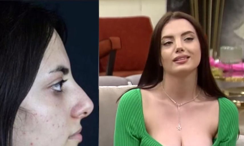 Kısmetse Olur Elif