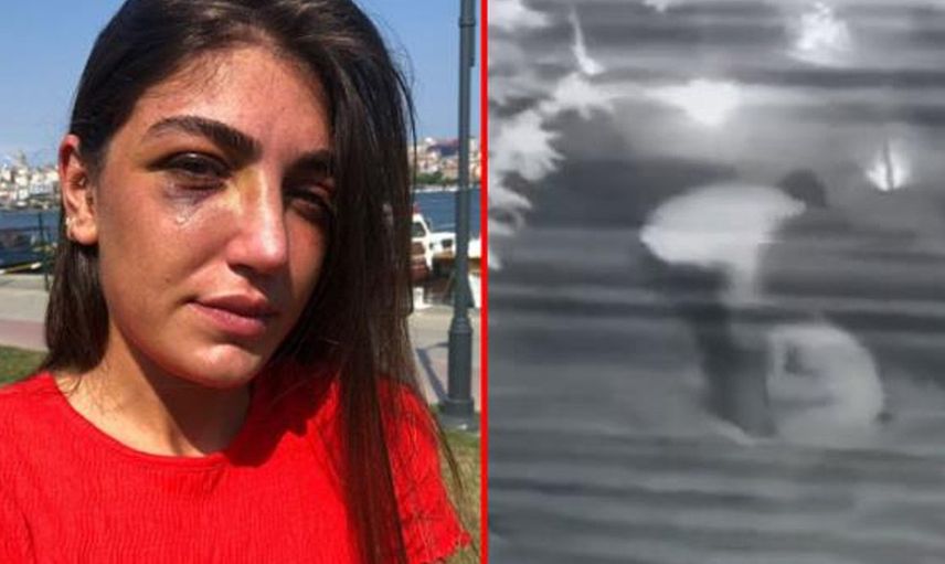 Manken Gizem Akbaş Eski Sevgilisi Tarafından Darp Edildi