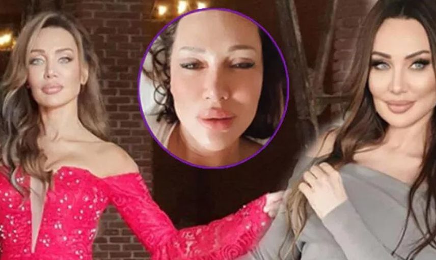 Yerli Adriana Lima Umut Akyürek güzelleşmek için yüzüne sülük yapıştırdı bin pişman olan Akyürek'in o hali herkese ders oldu