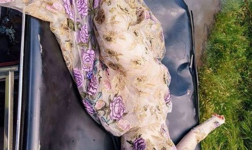 Hadise'nin Klibinde Canlandırdığı Tüm Zamanların En Güzel İntiharı Olarak Kayıtlara Geçen McHale'in Trajik Hikayesi