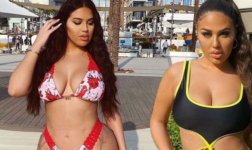 Love Island’ın Anna Vakili’si popo ameliyatı için Türkiye’ye geldi: “Cinayet mahalli gibiydi, öleceğimi sandım”
