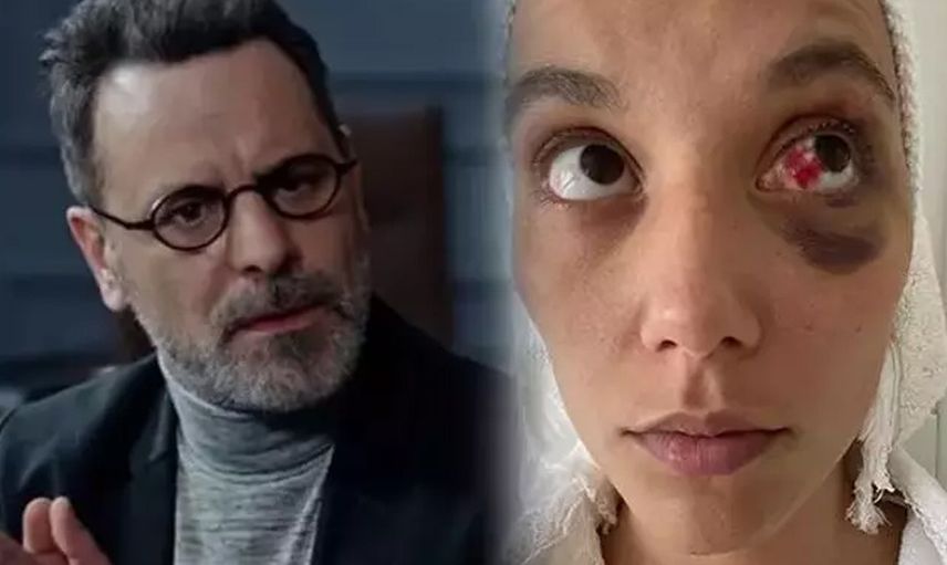 Ozan Güven'in eski sevgilisi Deniz Bulutsuz'u darp ettiği davada son gelişme: Adli Tıp Kurumu raporu hazırladı