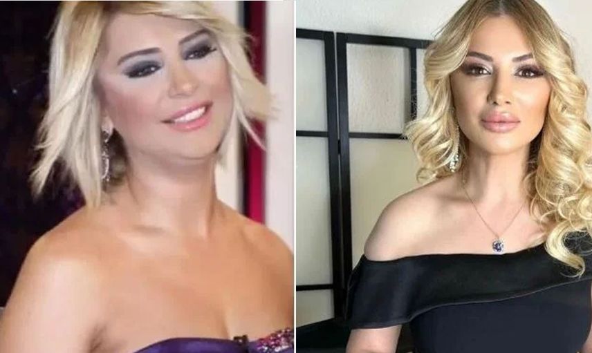 Songül Karlı estetikle Hadise'ye benzedi