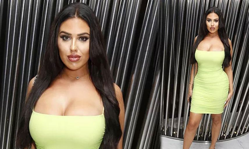Love Island’ın Anna Vakili’si popo ameliyatı için Türkiye’ye geldi: “Cinayet mahalli gibiydi, öleceğimi sandım”