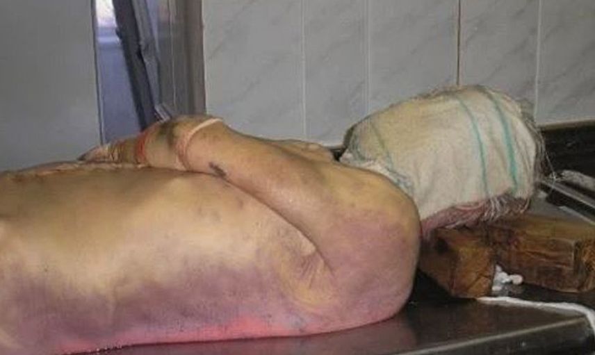 Öldükten sonra vücudumuzda meydana gelecek 15 tuhaf değişim