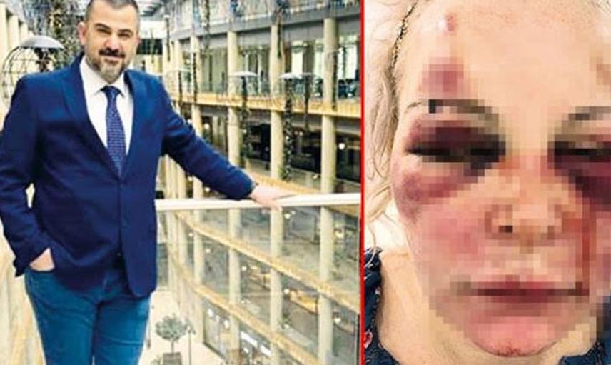 Rus Kadının Otel Odasında Gördüğü Şiddetin Boyutları Duyanları Şok Etti