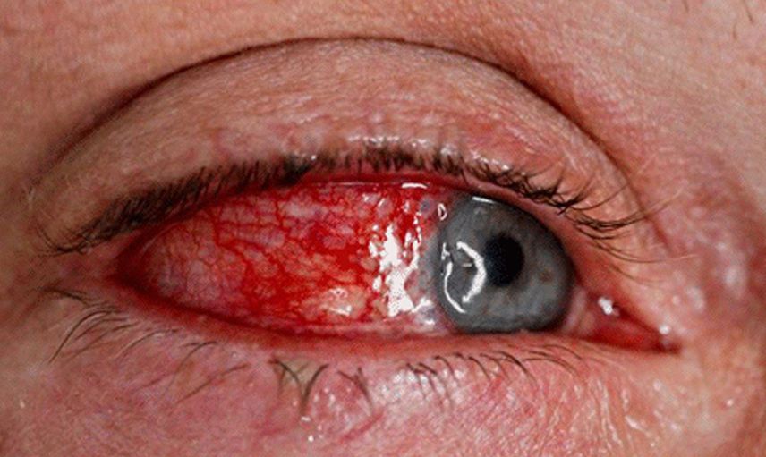 Egzama dediler kasık biti çıktı: Küçük çocuğın başına gelmeyen kalmadı!