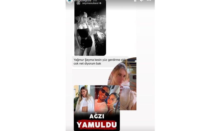Şeyma Subaşı'nın eski fotoğrafları