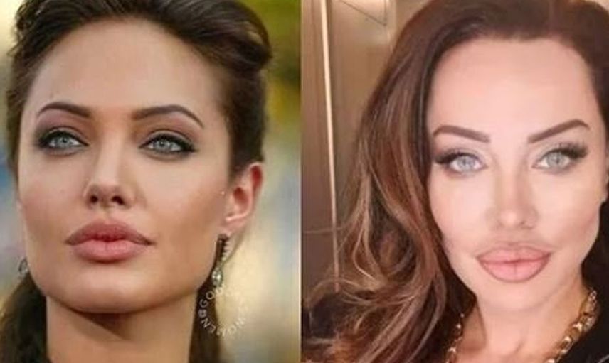 Yerli Adriana Lima Umut Akyürek güzelleşmek için yüzüne sülük yapıştırdı bin pişman olan Akyürek'in o hali herkese ders oldu