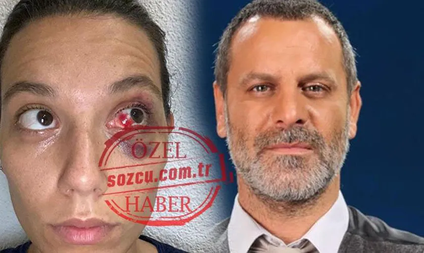 Ozan Güven İle Deniz Bulutsuz, Birbirleri Hakkında Uzaklaştırma Kararı Aldırdı