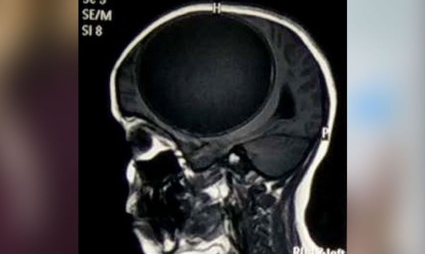 Felçli kızı muayene eden doktor sebebini anlayınca hayret etti