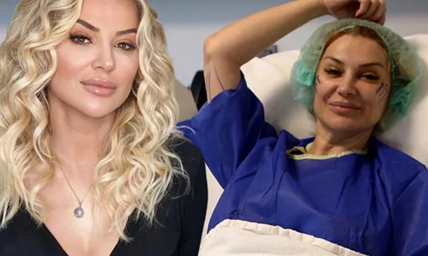 Songül Karlı'nın yeni hali ortaya çıktı! Bıçak altına yatan ünlü oyuncu bakın kime benzetildi
