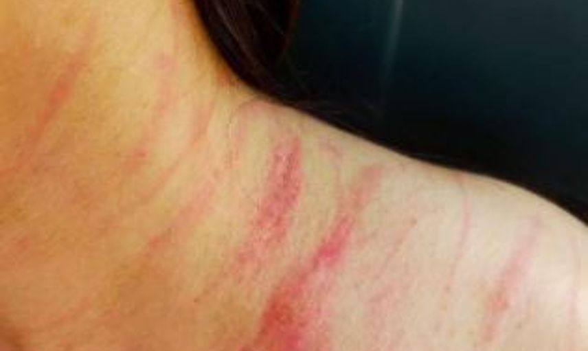 Hatay'da Doktorların Muayene Kavgası Kötü Bitti!