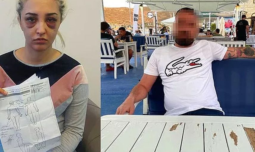 İzmir’de korkunç olay! Gamze Tümtürk’ün sevgilisi önce dövdü sonra uyumak istedi