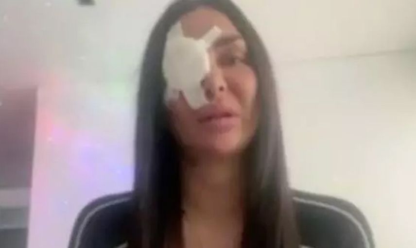 Canlı yayında korkunç olay! Tiktok fenomenin yüzüne asit attılar