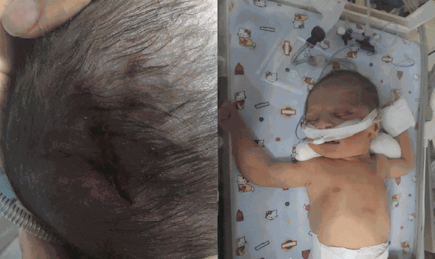 Özel Hastanede Doğum Sırasında Düşürülen Azra Bebek Yaşam Savaşı Veriyor