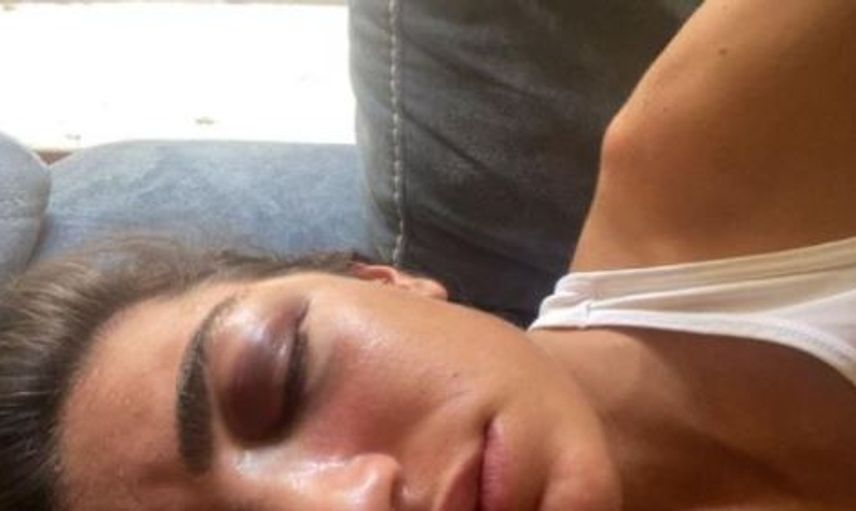 Manken Gizem Akbaş Eski Sevgilisi Tarafından Darp Edildi