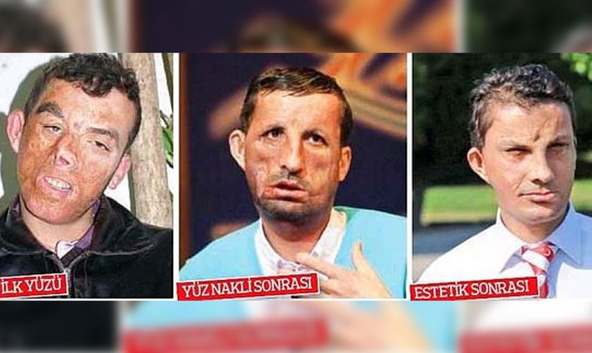 Uğur Acar