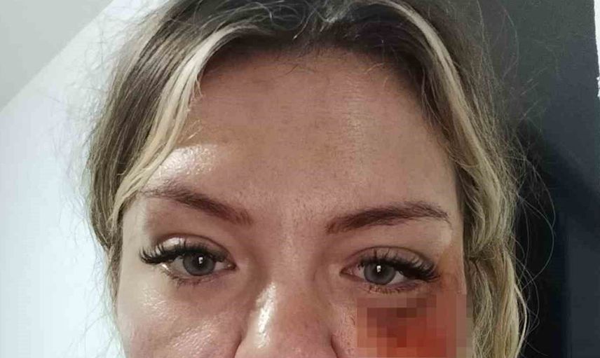 Bıçaklı saldırgan kasten öldürmeye teşebbüsten yargılanıyor