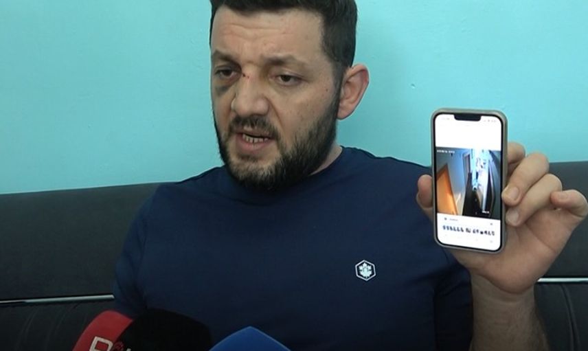 14 Aylık bebek ve babasına scooter'la  saldıran vicdansız için 36 yıl hapis !