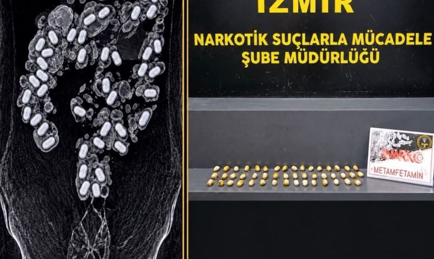 Uyuşturucu kuryesi havalimanında yakalandı: Midesinde 47 kapsül metamfetamin bulundu