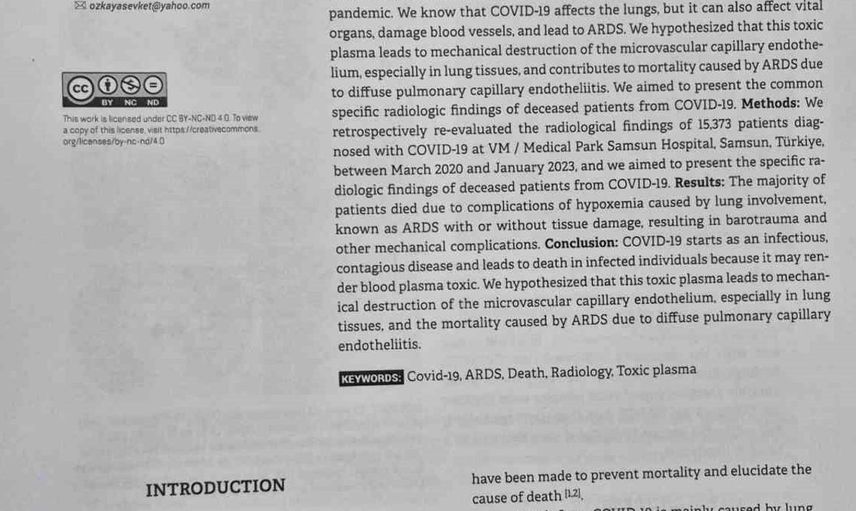Covid-19'a bağlı ölümlerin nedenleri belirlendi