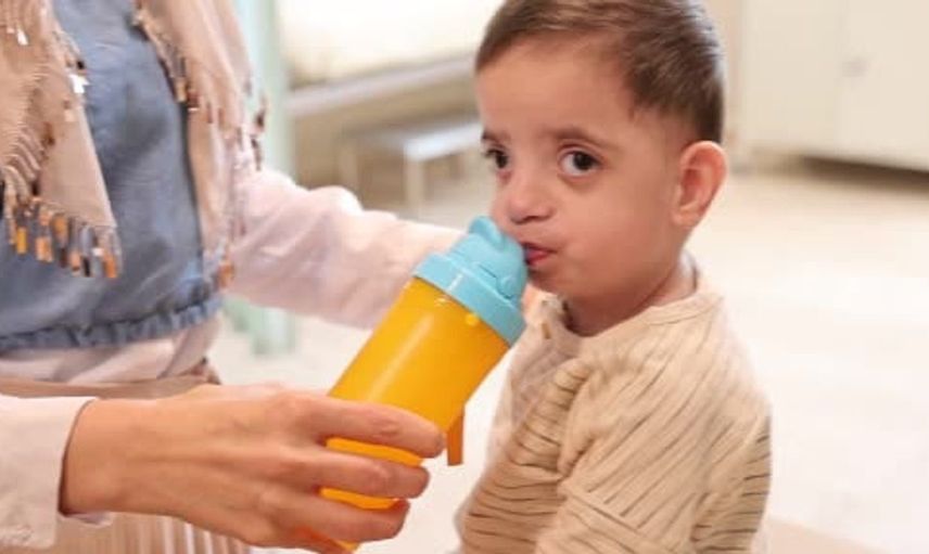 Doğuştan nadir hastalıkla 1,5 yıl süren mücadele başarıyla sona erdi