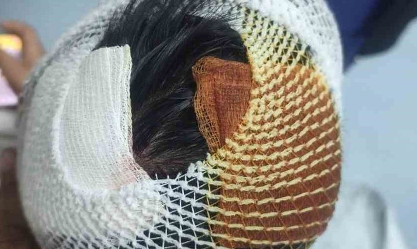 Sokak köpekleri saldırısında yaralanan çocuğa 15 dikiş atıldı