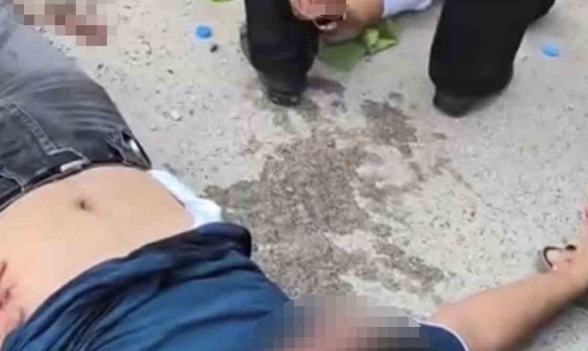 Adıyaman'da silahlı kavgada iki kişi ağır yaralandı
