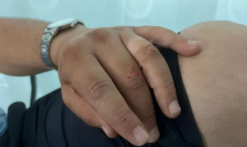 Bursa'da seyyar satıcı denetiminde gergin anlar: Zabıta memuru hastaneye kaldırıldı