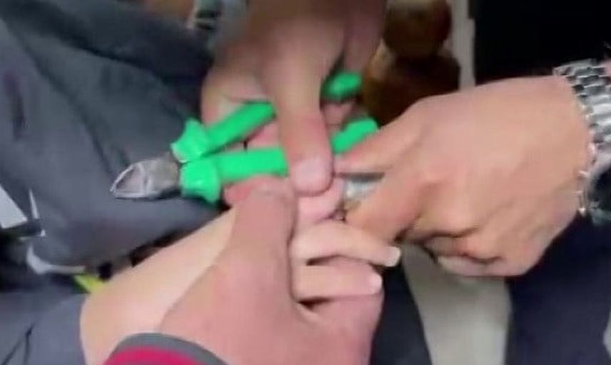 Küçük kızın parmağını boruya sıkıştırması itfaiye ekiplerini alarma geçirdi