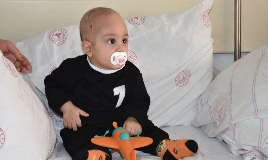 7 aylık bebeğin kafatasındaki şekil bozukluğu ameliyatla düzeltildi!