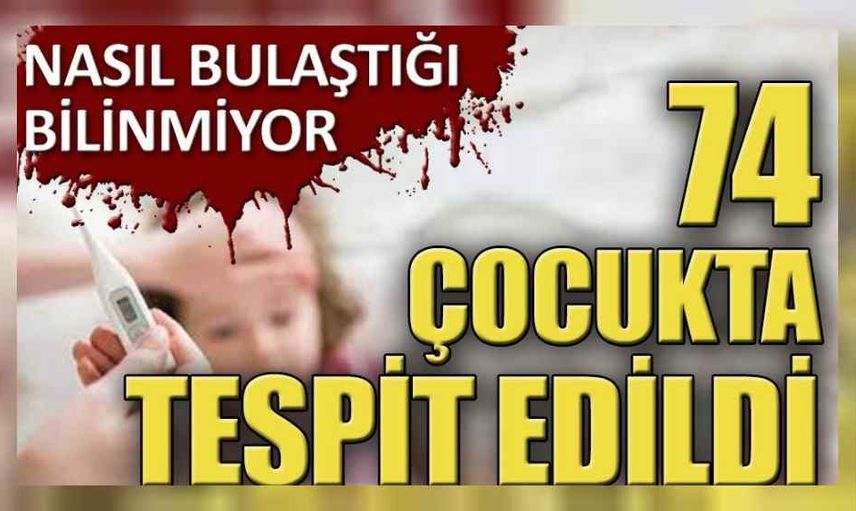 74 çocukta belirti gösteren gizemli hastalık nedir? Gizemli hastalık belirtileri nelerdir? Gizemli hastalık panik yaratmaya devam ediyor!