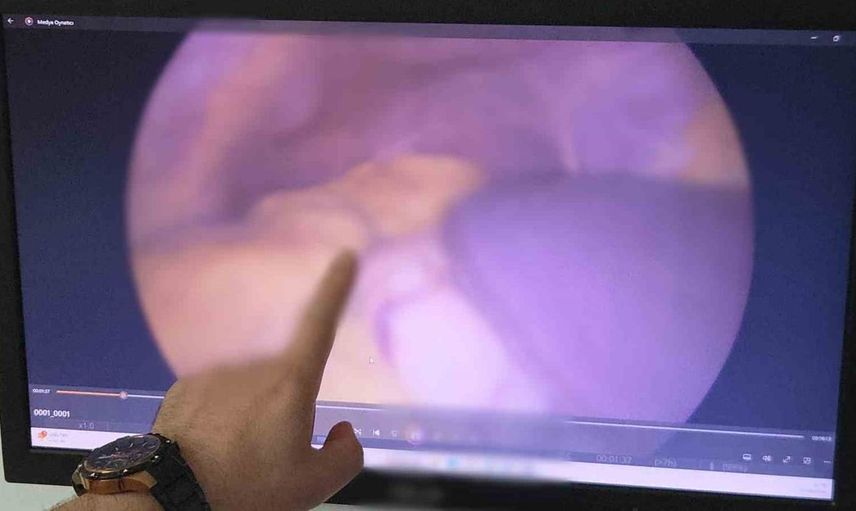 Hastanın organları ters yerleşimli: 10 binde bir görülen durum