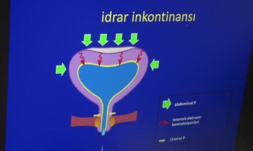 İdrar kaçırma sorununa dikkat: utangaçlık başvuruyu engelliyor