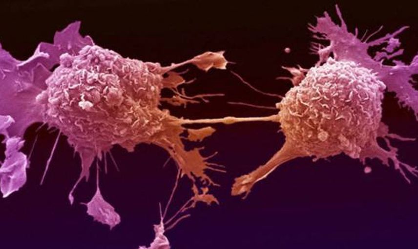 ABD'de Yeni Salgın Patlak Verdi, Salmonella Yayılıyor!