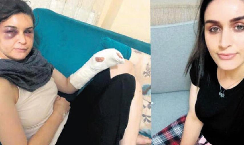 Boşanmak İsteyen Eşine Ailece İşkence Etmişlerdi! Cezaları Belli Oldu