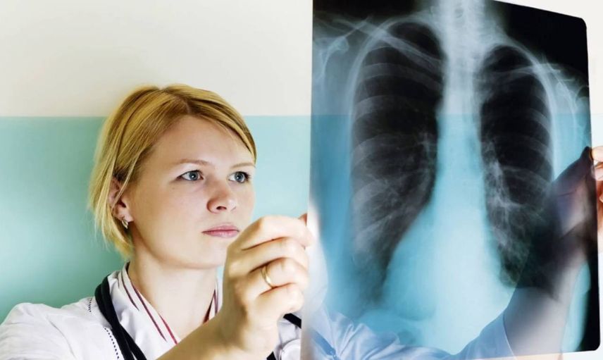 Akciğer kanserinin belirtileri nelerdir? Ciğerlerde ağrı kansere mi işaret? Akciğer kanseri nedir ve tedavisi nasıl yapılır?