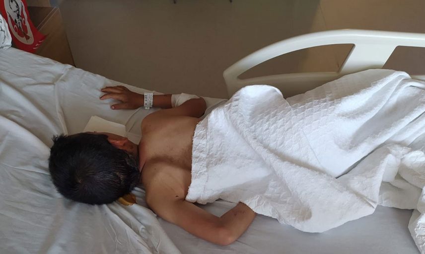 Ankara'da 8 yaşındaki Burak'a uçurtma uçururken köpekler saldırdı: İnsan hayatı bu kadar ucuz olmamalı!