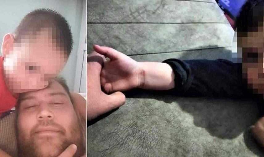 Antalya’da kan donduran olay! Çocuğunun ellerini yaktı…