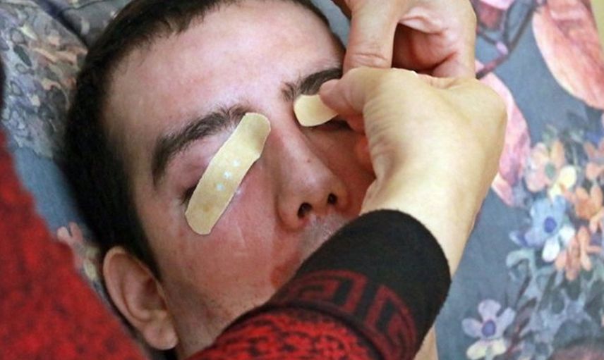Antalya’da Yaşayan Genç Adamın Başına Öyle Bir Şey Geldi ki 8 Yıldır Gözlerini Kapatamıyor