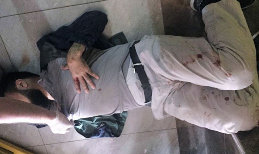 Asansöre Binen Baba Ve Oğlu, 11'inci Kattan Yere Çakıldı