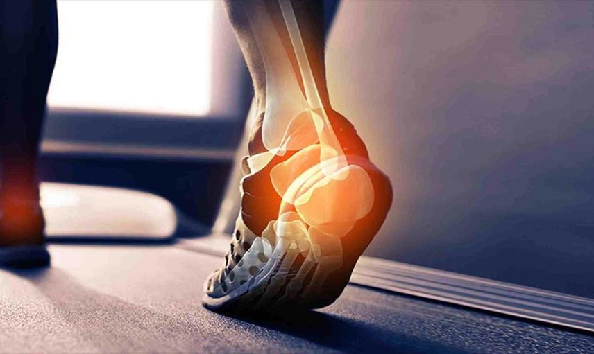 Aşil Tendonu kopması nedir, neresi ve vücutta nerede? Aşil tendonu kopması tedavi süreci ne kadar sürer?